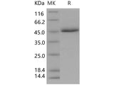 Recombinant Human CD5 Protein (His Tag)(Active)