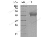 Recombinant Human IL-22BP/IL22RA2 Protein (His Tag)(Active)