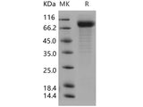 Recombinant Human IL-22BP/IL22RA2 Protein (His & Fc Tag) 