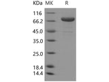 Recombinant Human Transferrin Receptor/TFRC Protein (His Tag)(Active)