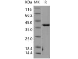 Recombinant Human CSNK2A2/CK2A2 Protein