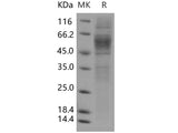 Recombinant Human GPR56/TM7LN4 Protein (His Tag)