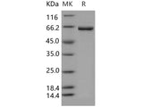 Recombinant Human CROT Protein (474 Leu/Val, His Tag)