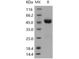 Recombinant Human CNTFR/CNTFR-alpha Protein (His Tag)(Active)