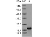 Recombinant Human Troponin C/TNNC1 Protein