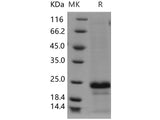 Recombinant Human CD20/MS4A1 Protein (aa 213-297, His Tag)