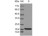 Recombinant Human KIAA0101/p15/PAF Protein (His Tag)