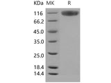 Recombinant Human SerpinG1/C1IN Protein (His Tag)(Active)