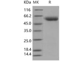 Recombinant Human SerpinA7/TBG Protein (His Tag)