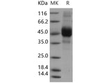 Recombinant Human CD3d/CD3 delta Protein (Fc&FLAG Tag)