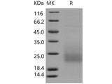 Recombinant Human CD3d/CD3 delta Protein (His Tag)