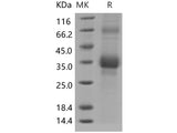 Recombinant Human CLEC1B/CLEC2 Protein (His Tag)(Active)