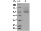 Recombinant Human IL7RA/CD127 Protein (His Tag)(Active)