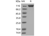 Recombinant Human IL6ST/CD130 Protein (His & Fc Tag)(Active)