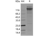 Recombinant Human vWF Protein (His Tag)