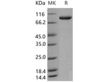 Recombinant Human ACO1/irp1 Protein (His Tag)