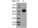 Recombinant Human Prostatic Acid Phosphatase/ACPP Protein (His Tag)(Active)