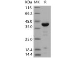 Recombinant Human ACP1/LMW-PTP Protein (GST Tag)(Active)