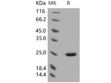 Recombinant Human SDF2 Protein (His Tag)