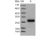 Recombinant Human MESDC2/MESD Protein (His Tag)