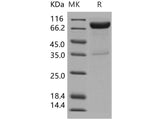 Recombinant Human IL10RB/IL10R2 Protein (His & Fc Tag)(Active)