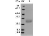 Recombinant Human C1QB/C1qB Protein (His Tag)