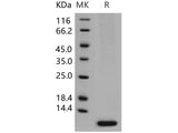 Recombinant Human S100A6 Protein (Baculovirus, His Tag)