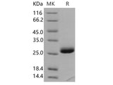 Recombinant Human TIMP-1/TIMP1 Protein (Active)