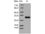 Recombinant Human TIMP-1/TIMP1 Protein (His Tag)(Active)