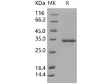 Recombinant Human Ficolin-1/Ficolin-A/FCN1 Protein (His Tag)(Active)