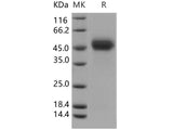 Recombinant Human uPAR Protein (His Tag)(Active)