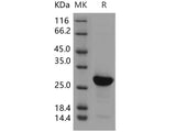 Recombinant Human H1F0/Histone H1 Protein (His Tag)