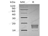 Recombinant Human TIGIT Protein (aa 1-138, His Tag)(Active)