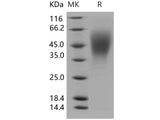 Recombinant Human OSTM1 Protein (His Tag)