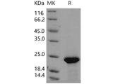 Recombinant Human FGF21 Protein (His Tag)