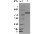 Recombinant Human ENTPD3/NTPDase3/CD39L3 Protein (His Tag)(Active)