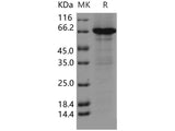 Recombinant Human CCNE1/Cyclin-E1 Protein (His & GST Tag)(Active)