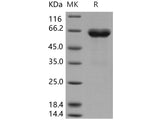 Recombinant Human Ephrin-B1/EFNB1 Protein (His & Fc Tag)(Active)