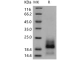 Recombinant Human BAMBI Protein (His Tag)