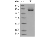 Recombinant Human ENPP7/NPP-7 Protein (His Tag)