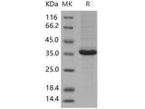 Recombinant Human MAP1D Protein (His Tag)(Active)