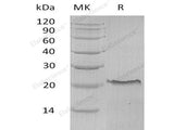 Recombinant Human TNFR1/TNFRSF1A Protein (HEK293 Cells, His Tag)(Active)