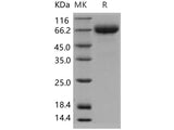 Recombinant Human Hemopexin/HPX Protein (His Tag)(Active)