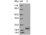 Recombinant Human LAIR2/CD306 Protein, Low Endotoxin