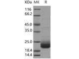 Recombinant Human LAIR2/CD306 Protein (Active)