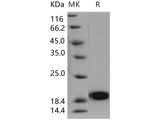 Recombinant Human PLA2G1B/PLA2 Protein (His Tag)(Active)