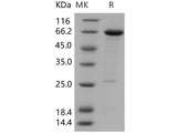 Recombinant Human HDAC8/HDACL1 Protein (GST Tag)