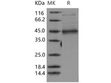 Recombinant Human MFG-E8/lactadherin/MFGE8 Protein (His Tag)(Active)