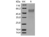 Recombinant Human PLA2G7/Lp-PLA2 Protein (His Tag)(Active)