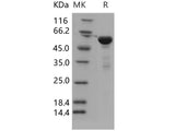 Recombinant Human 14-3-3 eta/YWHAH Protein (GST Tag)